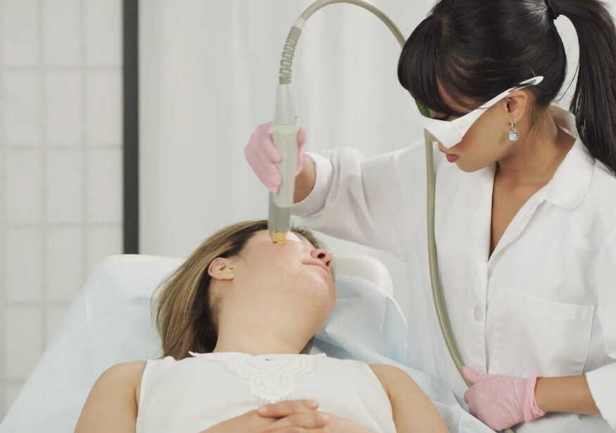 Врач удаляет сосуды на лице